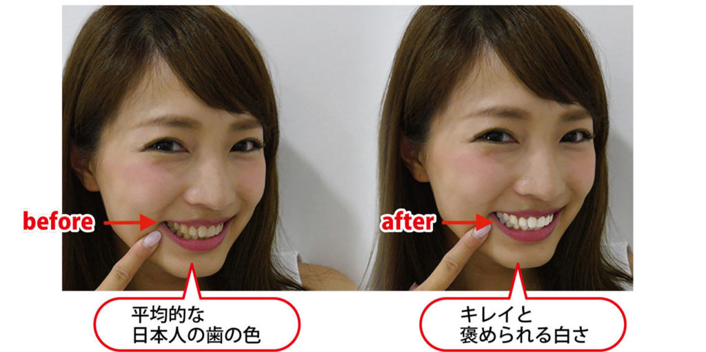 ホーチミン やくり歯科 デキる人は歯も白い 笑顔に自信 短期集中コースも Vetter ベトナム在住日本人向けメディア